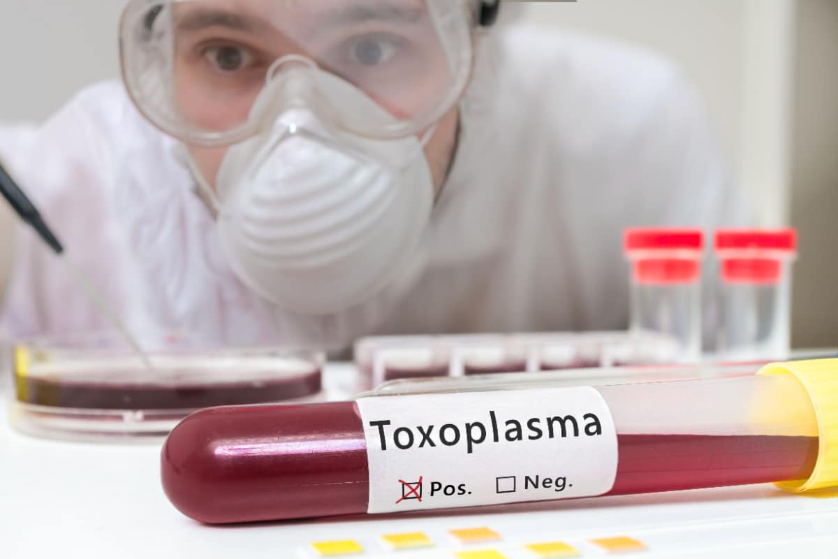 Toxoplasmose